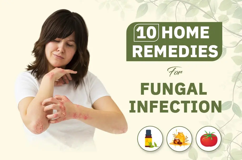 Top 10 Effective Home Remedies for Recovering From Fungal Infection According To Ayurveda