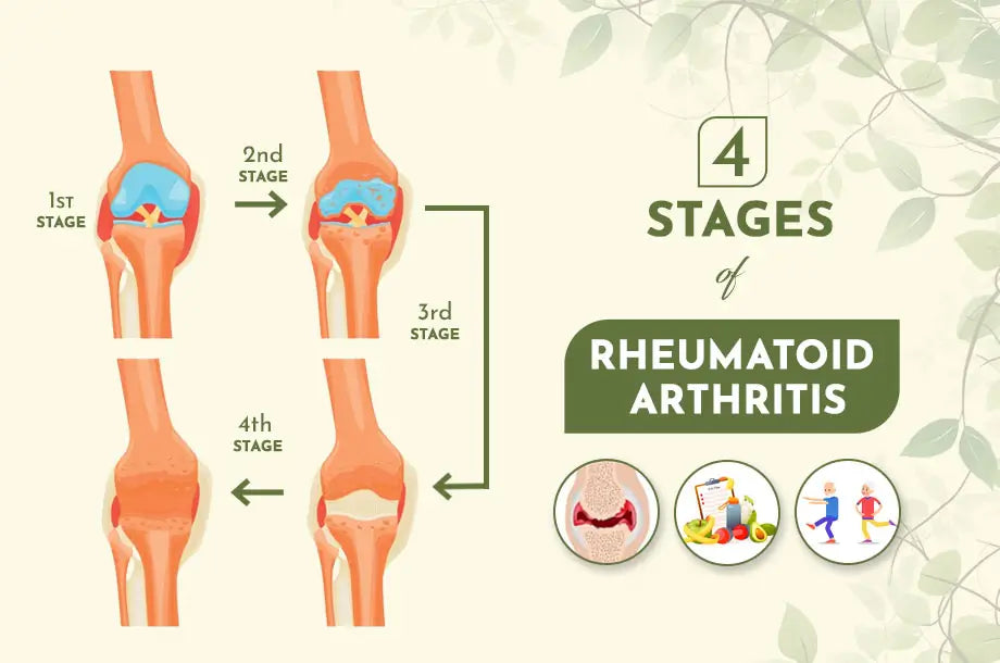 What are the 4 Stages of Rheumatoid Arthritis and How it affects your Body?