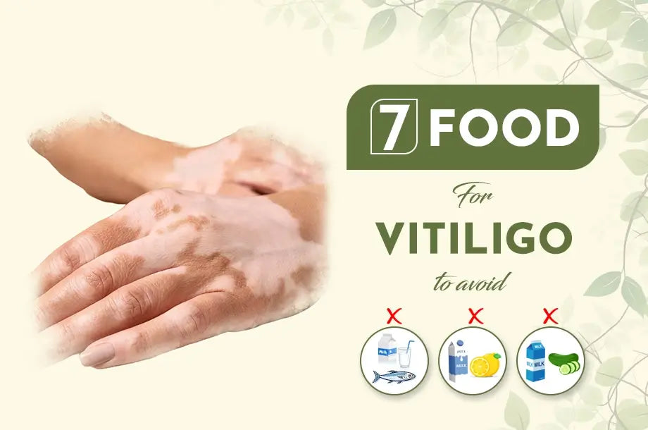 7 Food For Vitiligo to Avoid for Healthy Skin