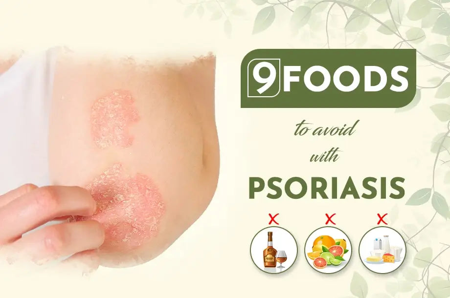 9 Foods to Avoid with Psoriasis for better skin health
