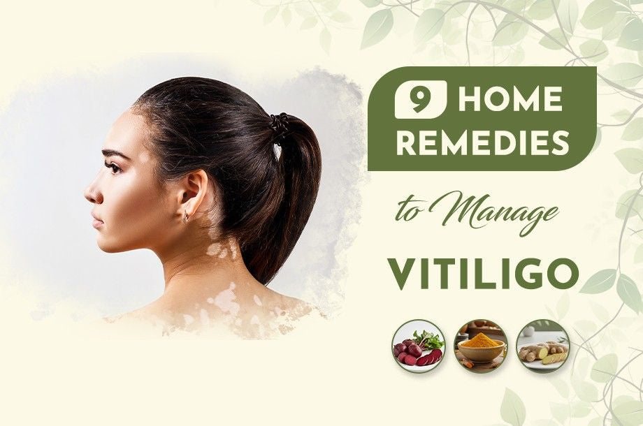 9 Home Remedies to Manage Vitiligo