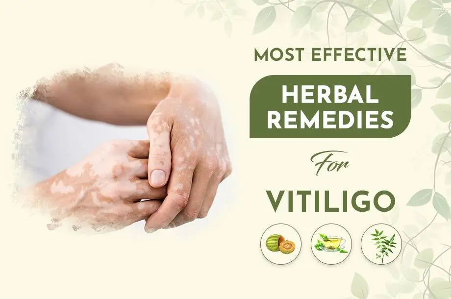 Effective Herbal Remedies for Vitiligo