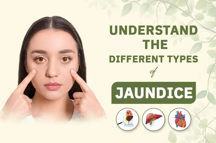 Understand the Different Types of Jaundice