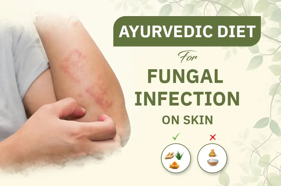 Recommended Ayurvedic diet for fungal infection on skin