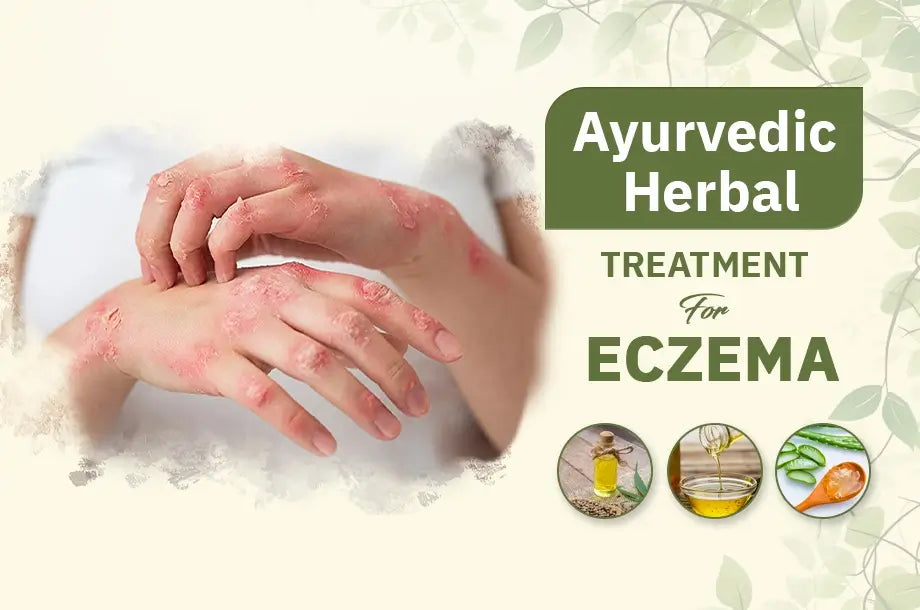 Eczema and how to treat it naturally. Learn about Ayurvedic herbs that can help provide relief