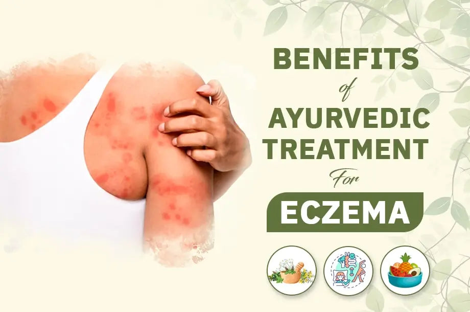 The Benefits of Ayurvedic Treatment for Eczema: A Comprehensive Guide