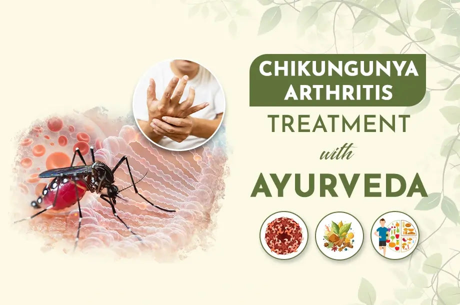 Chikungunya Arthritis Treatment with Ayurveda