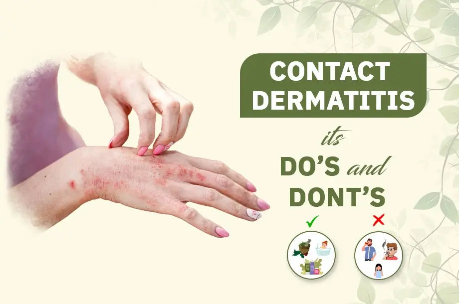 Dealing with Contact dermatitis: know its Do’s and Dont’s