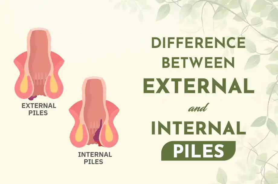 Know the Difference between External and Internal Piles