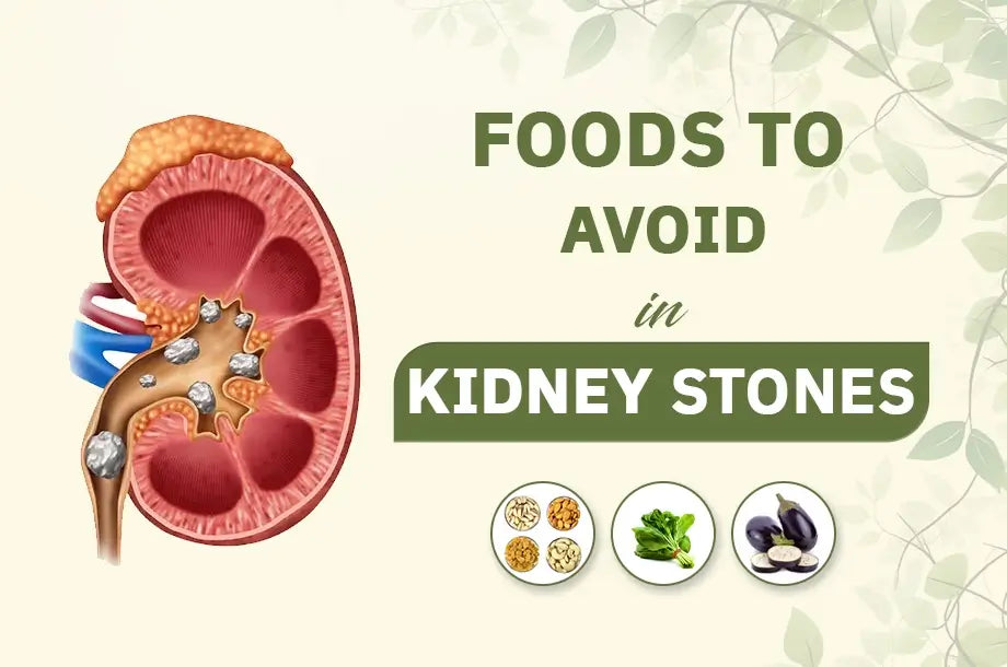 7 Foods to Avoid In Kidney Stones