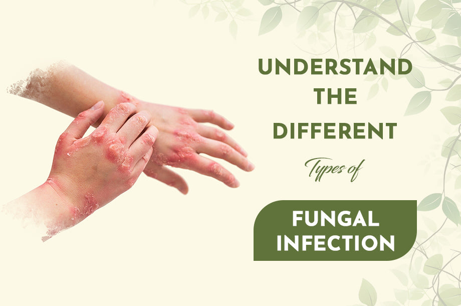 Understand the different types of fungal infection