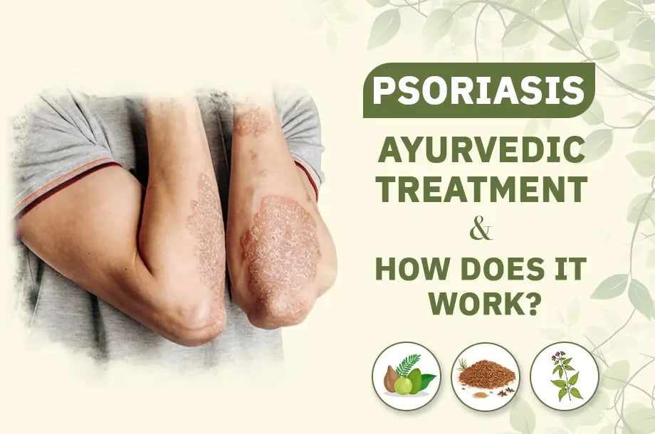 Psoriasis Ayurvedic Treatment & How Does It Work?