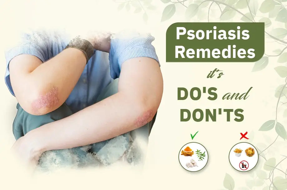 Best Ayurvedic Remedies for Psoriasis Treatment
