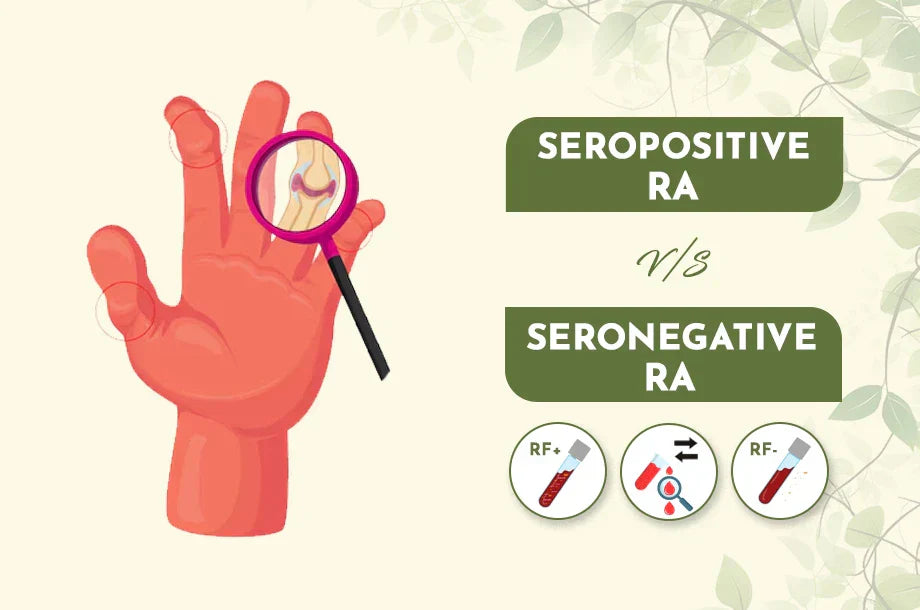 Seropositive v/s Seronegative Rheumatoid arthritis. How does Dr. Sharda Ayurveda treat these?