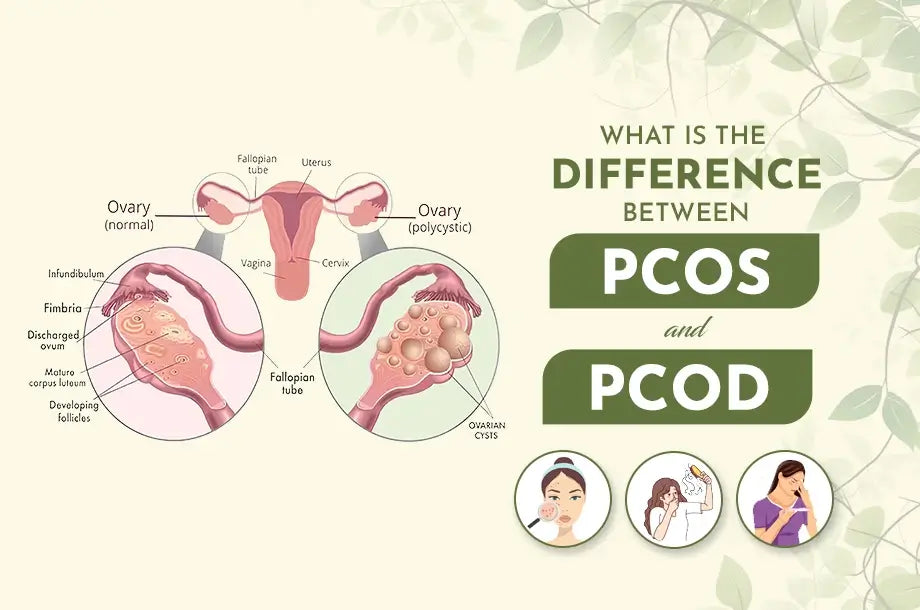 Know the difference between PCOS and PCOD