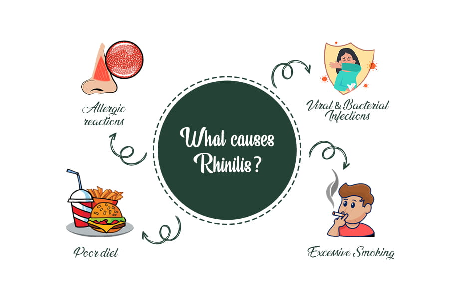list-of-causes-of-rhinitis